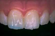 Repaired